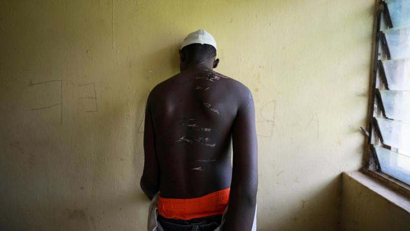 FILE PHOTO: A 14 year-old-boy, one of hundreds of men and boys rescued by police from an institution purporting to be an Islamic school, reveals scars on his back at a transit camp set up to take care of the released captives in Kaduna, Nigeria Sept 28, 2019. REUTERS