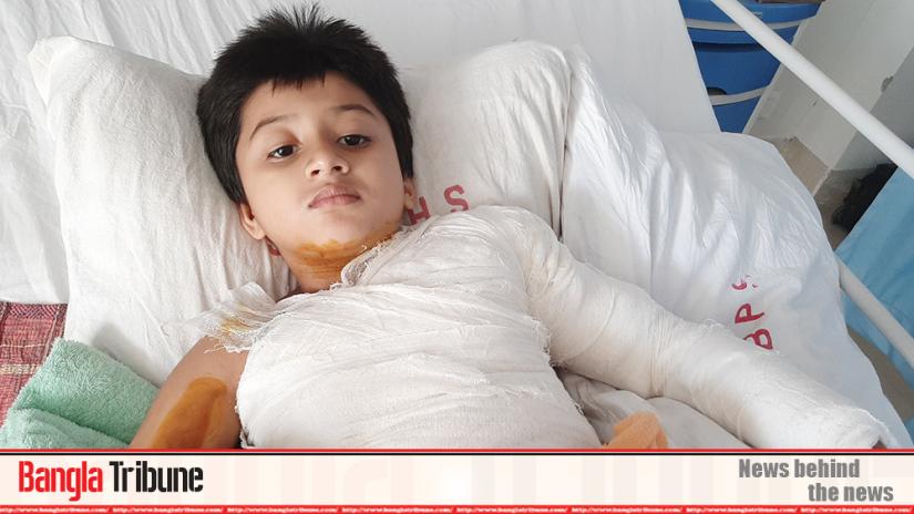 Arian, 7, sustained 12 percent burns but since Rajshahi Medical College did not have a burn unit, he was taken to Dhaka.