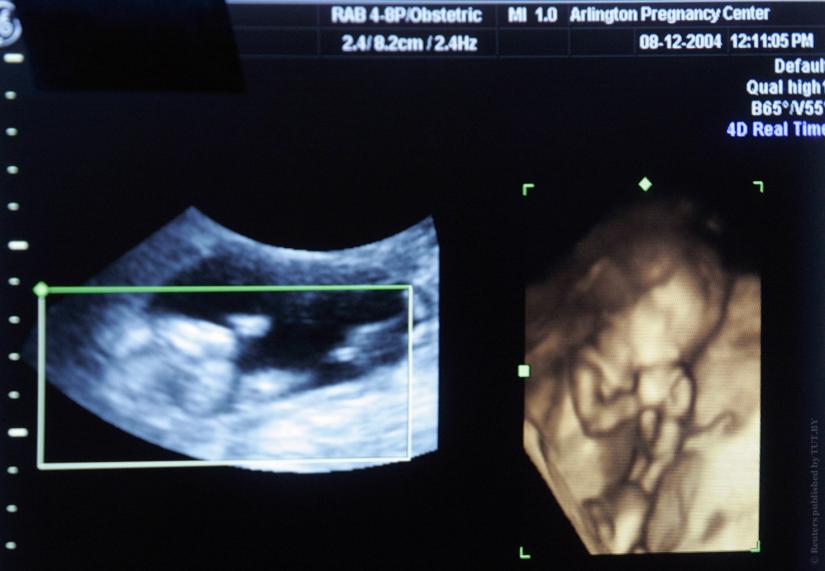 A four dimensional ultrasound is seen at a pregnancy clinic in Arlington, Texas November 26, 2007. REUTERS/File Photo