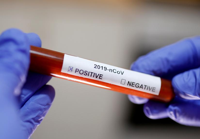 FILE PHOTO: Test tube with Corona virus name label is seen in this illustration taken on January 29, 2020. REUTERS