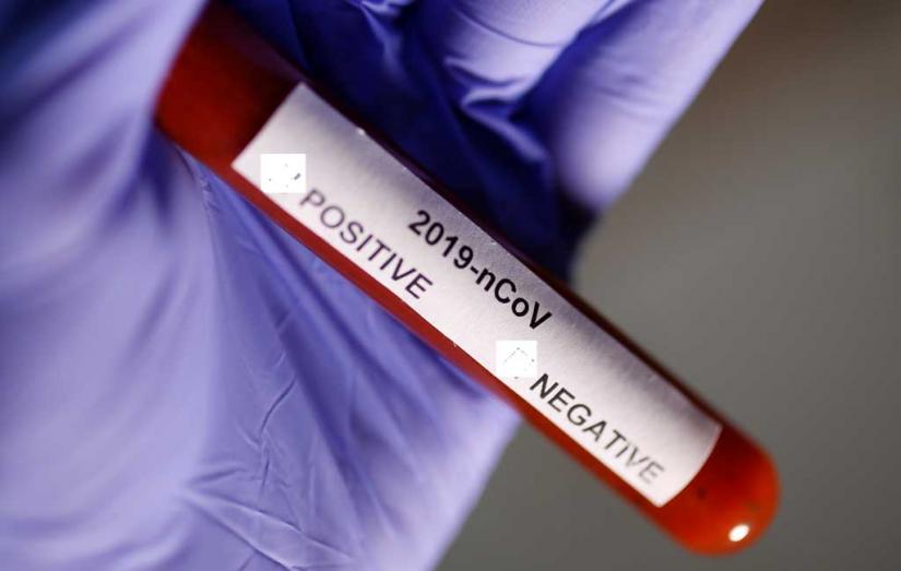Test tube with Coronavirus name label is seen in this illustration taken on Jan 29, 2020. File Photo/Reuters